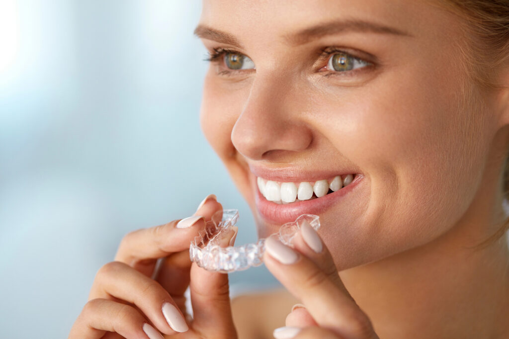 clear aligners